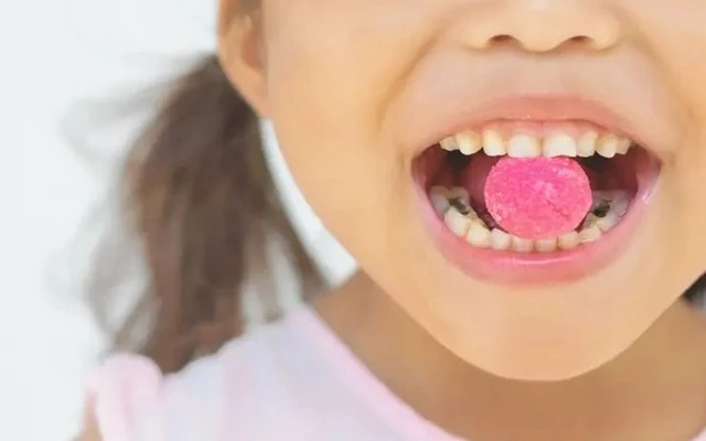 7 loại thực phẩm làm tăng nguy cơ sâu răng bạn nên biết để tránh- Ảnh 1. 7 loại thực phẩm làm tăng nguy cơ sâu răng bạn nên biết để tránh