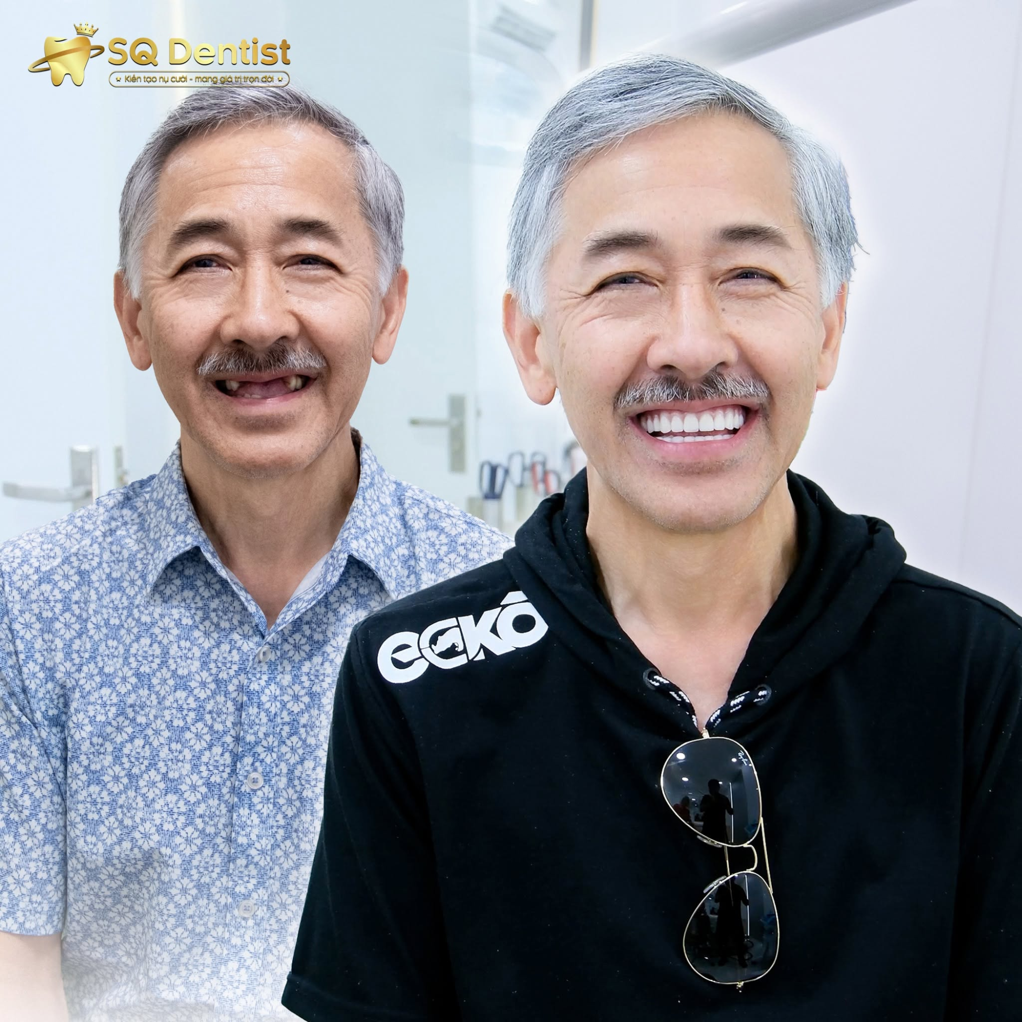 Làm răng Implant tại Việt Nam có an toàn không? Giải đáp 7 thắc mắc lớn nhất của Việt kiều trước khi về nước