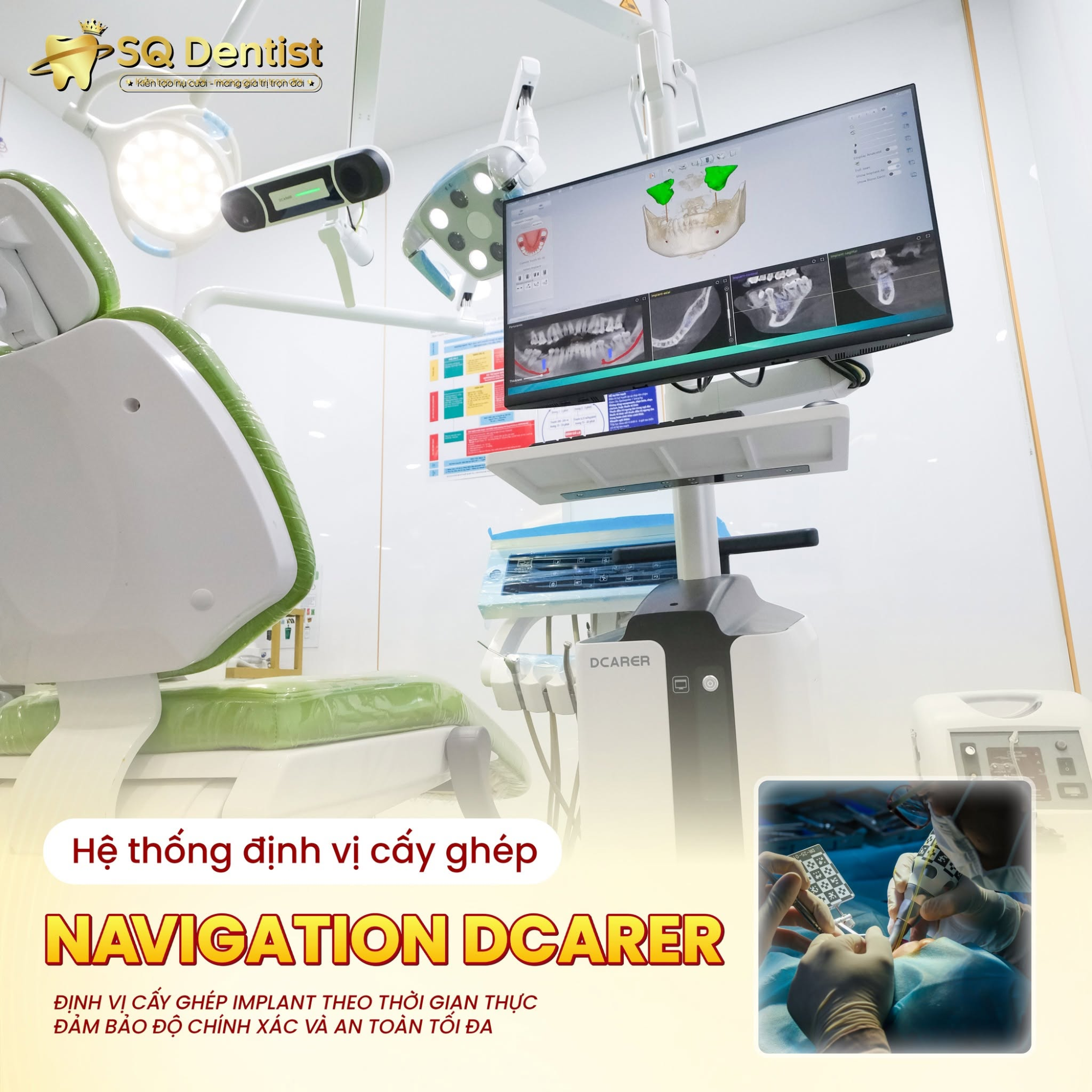 Làm răng Implant tại Việt Nam có an toàn không? Giải đáp 7 thắc mắc lớn nhất của Việt kiều trước khi về nước