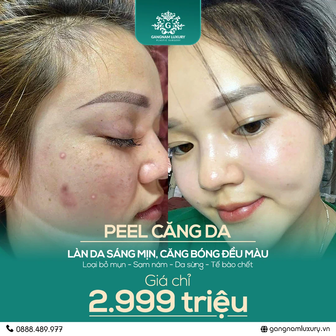 Top 3 cơ sở trẻ hóa căng da mặt uy tín tại TPHCM