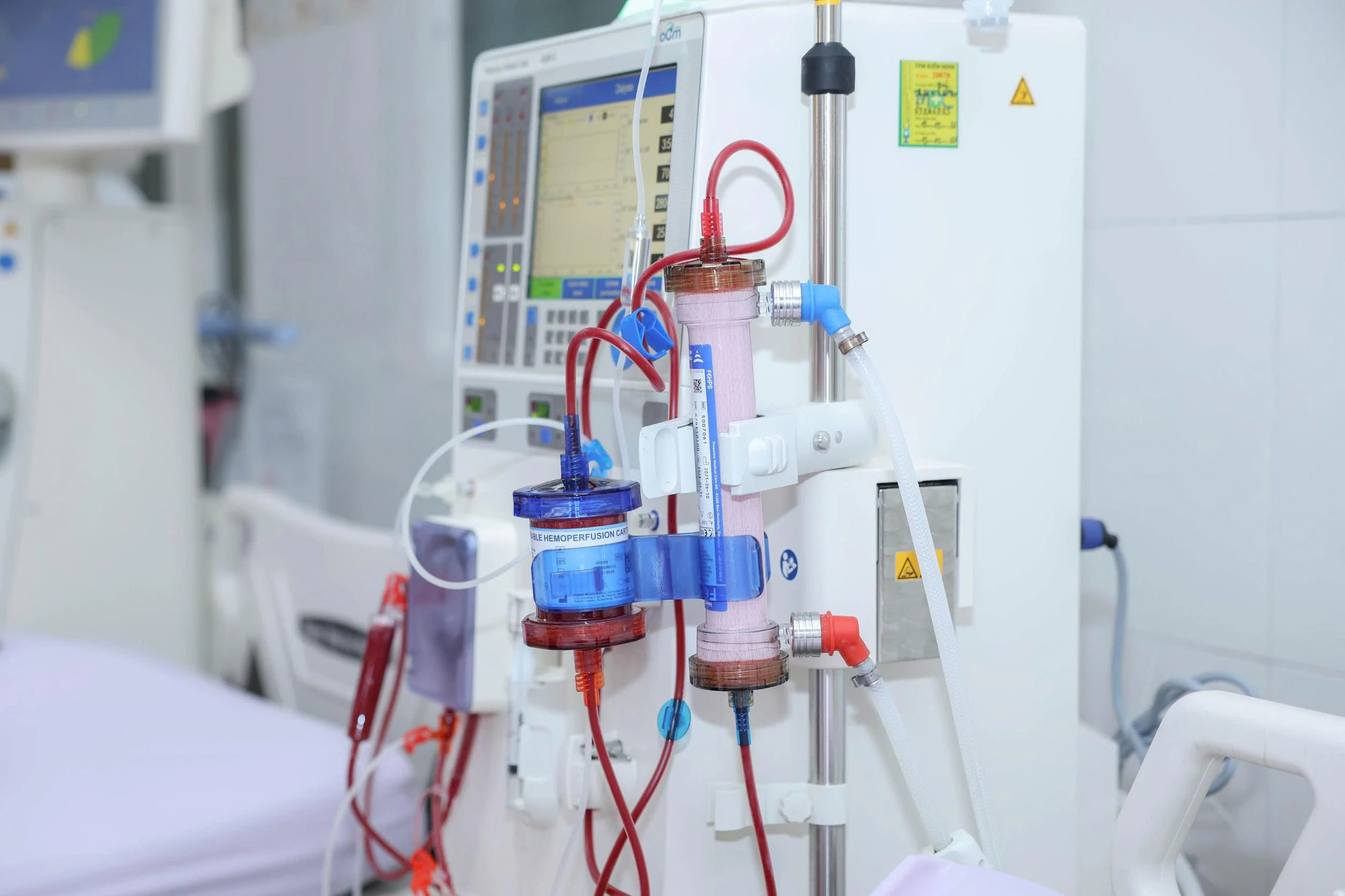 Làm sạch sâu dòng máu - bước tiến mới trong điều trị suy thận tại Thanh Hóa