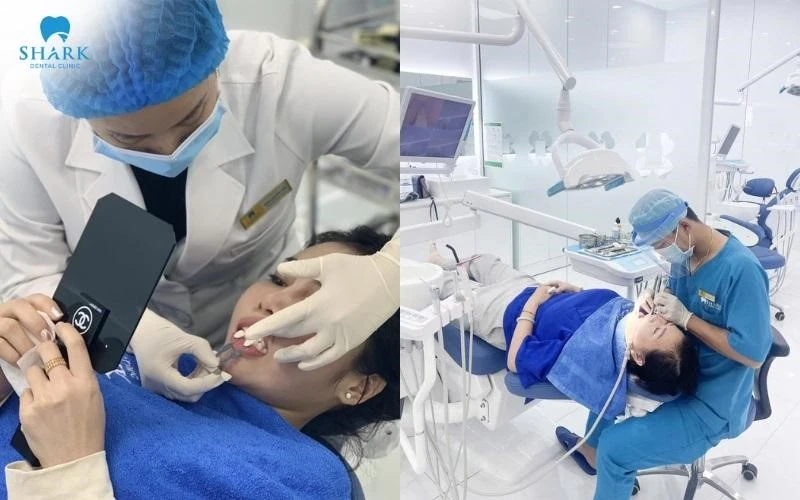 Bọc răng sứ Cercon XT - Giải pháp phục hình thẩm mỹ cao cấp