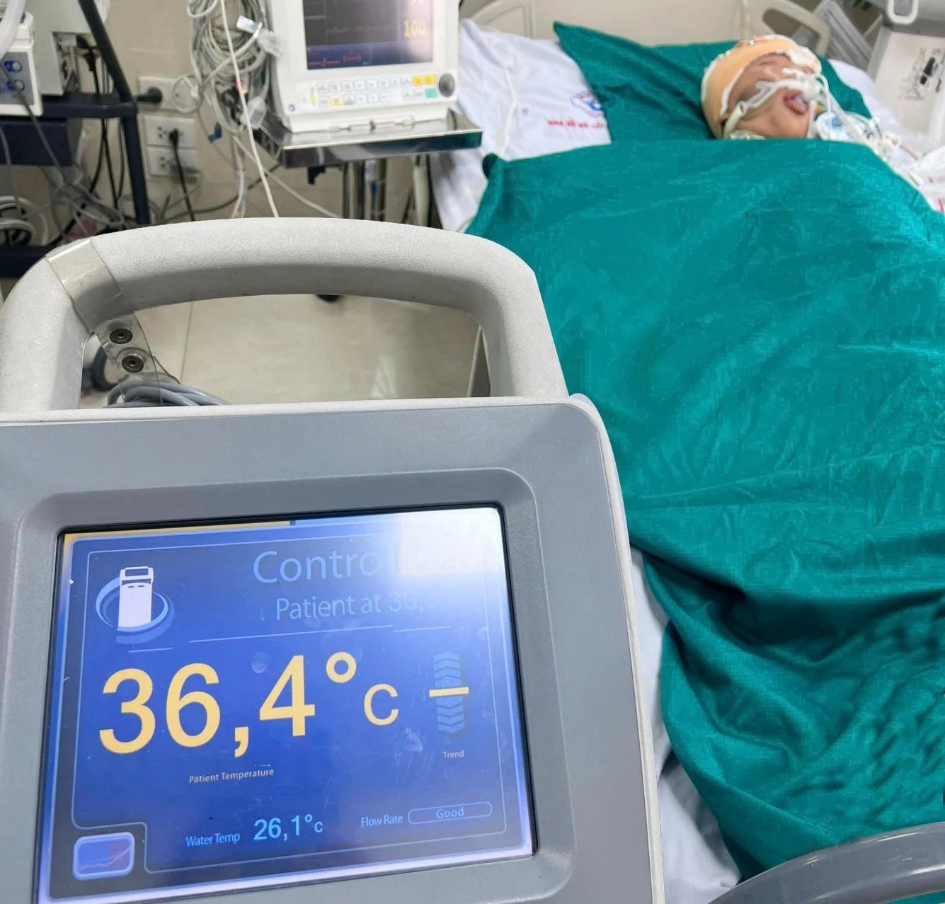 Kỹ thuật hạ thân nhiệt chỉ huy đã giúp bé trai 16 tuổi thoát khỏi cửa tử