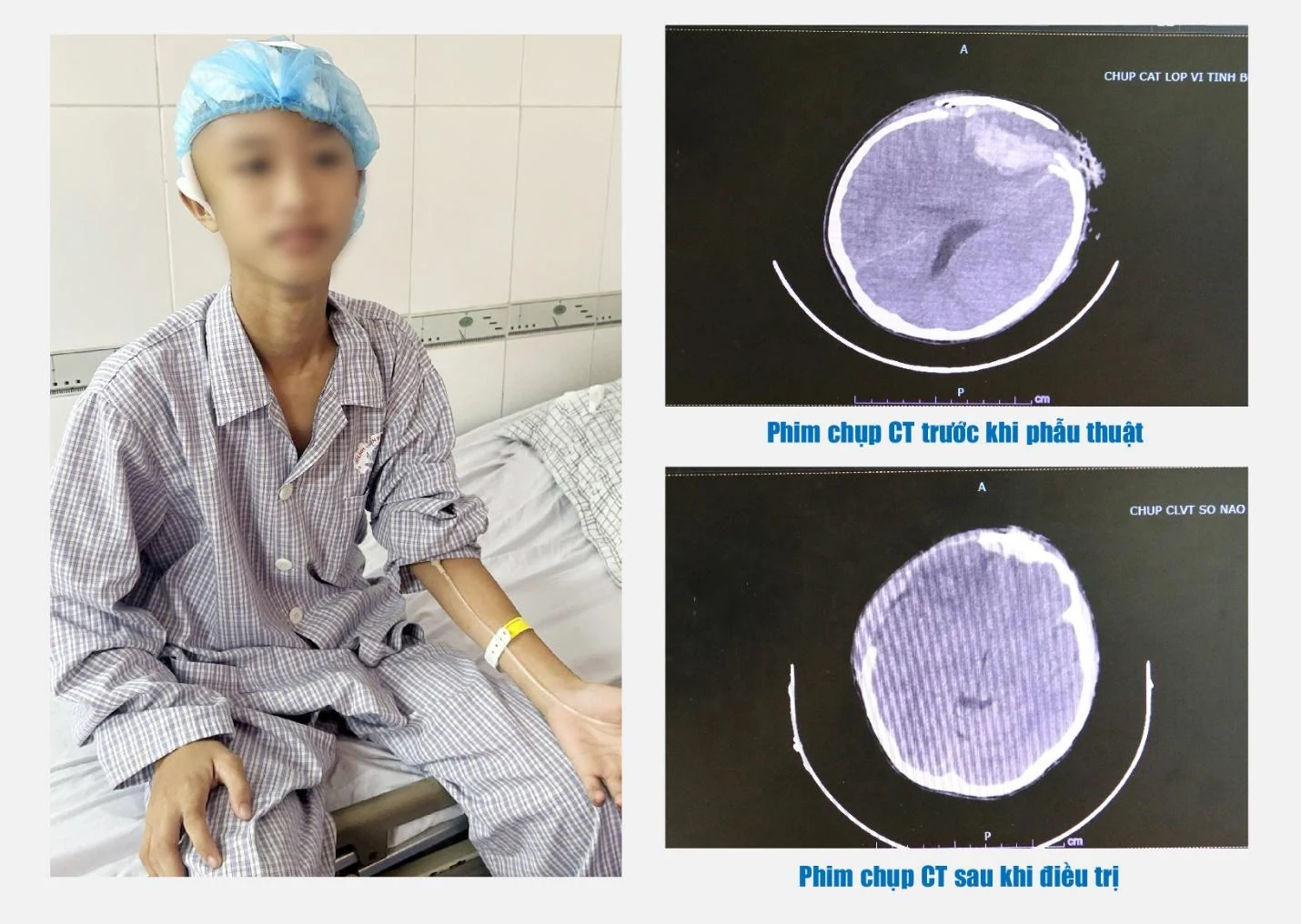 Kỹ thuật hạ thân nhiệt chỉ huy đã giúp bé trai 16 tuổi thoát khỏi cửa tử