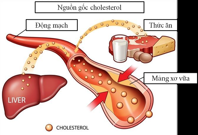 5 loại thực phẩm giúp kiểm soát mức cholesterol