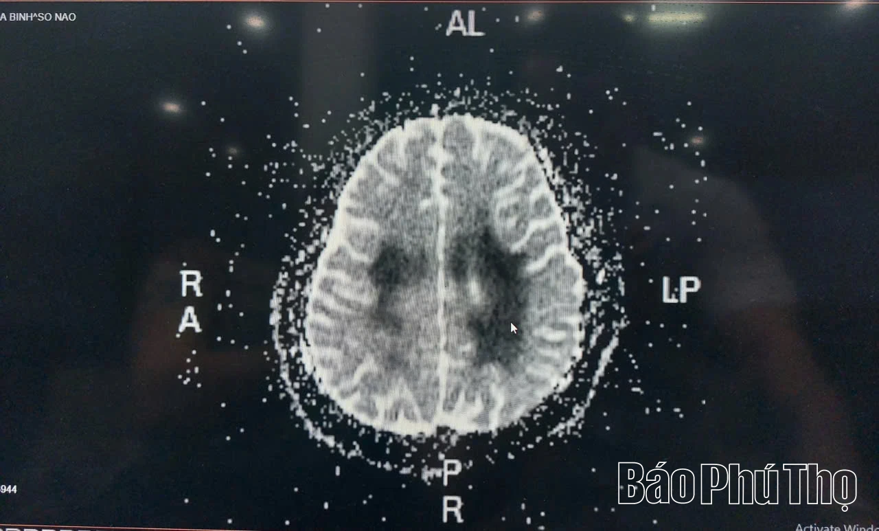 Thuốc lá điện tử - hiểm họa khôn lường với thế hệ trẻ