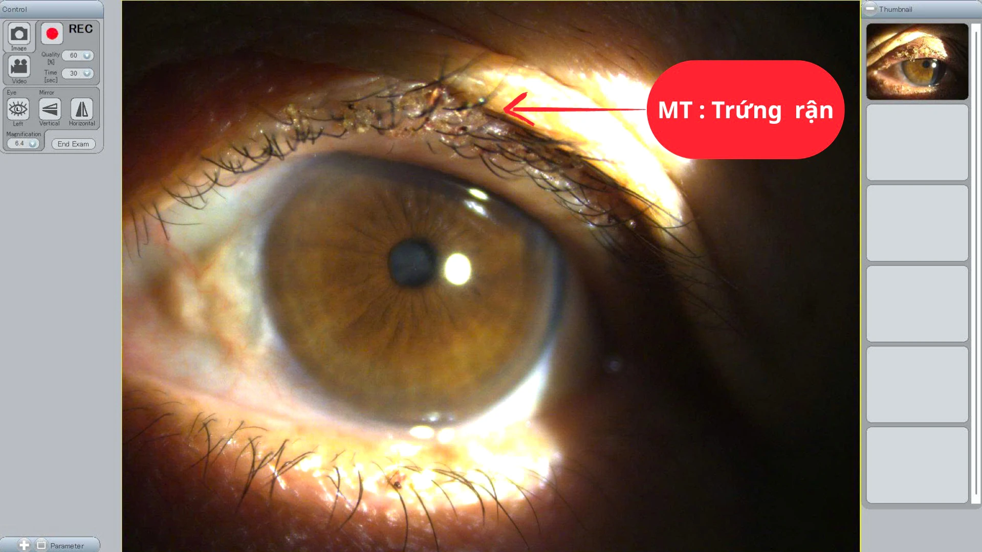 Cảnh giác với rận mi