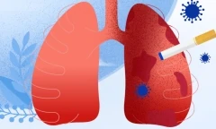 Vì sao bỏ thuốc lá vẫn có nguy cơ ung thư phổi?