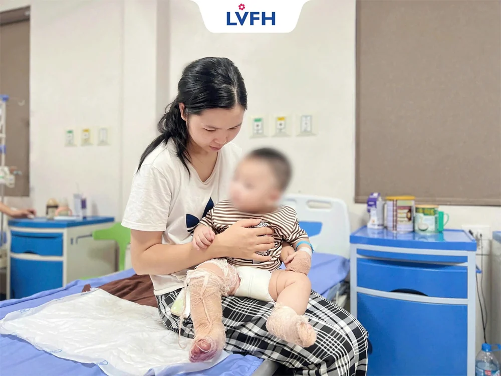 Lạc Việt kịp thời xử trí nhiều trường hợp bệnh nhi bị bỏng nặng, giảm nguy cơ biến chứng