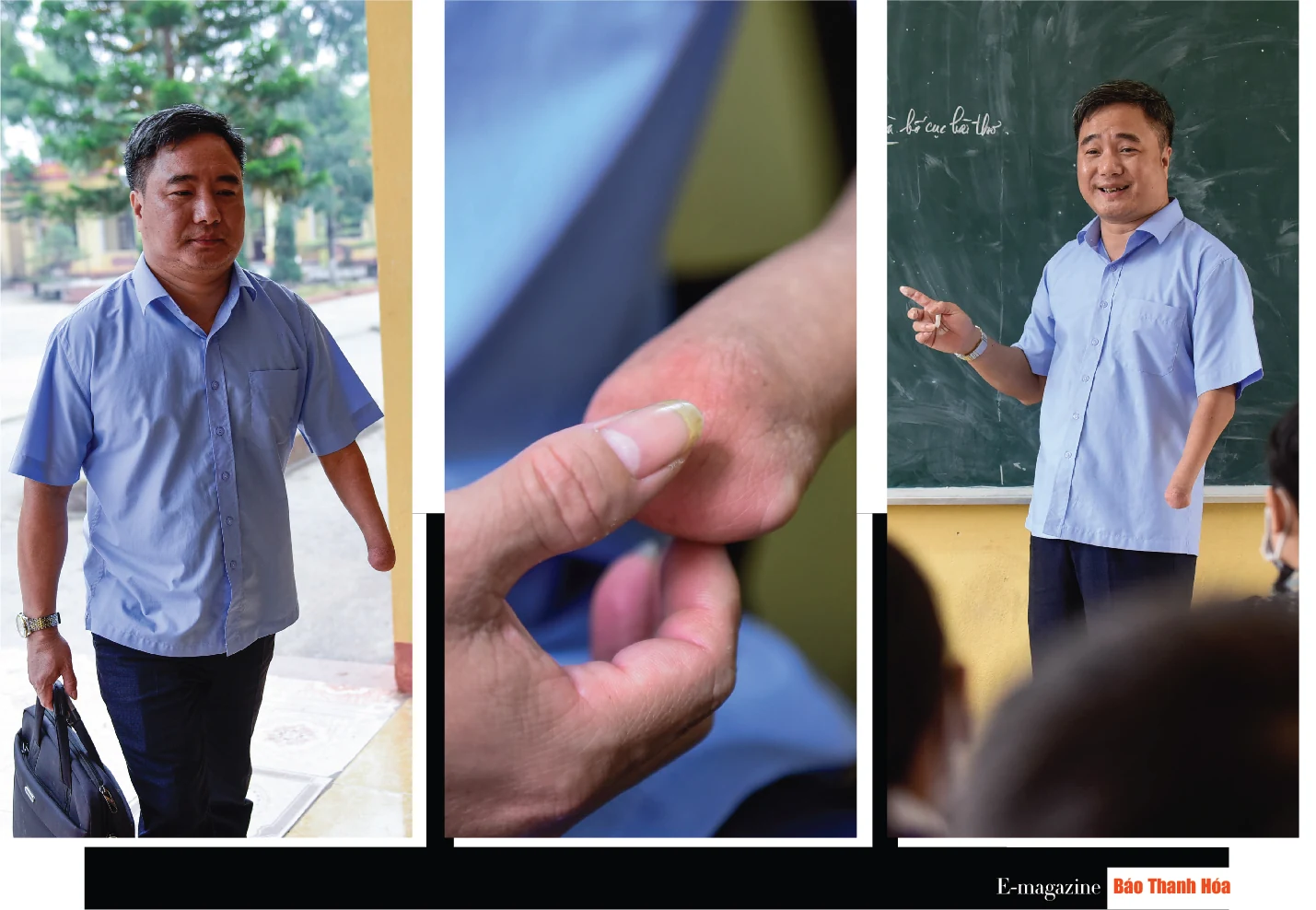 [E-Magazine] - Chung tay xoa dịu nỗi đau da cam