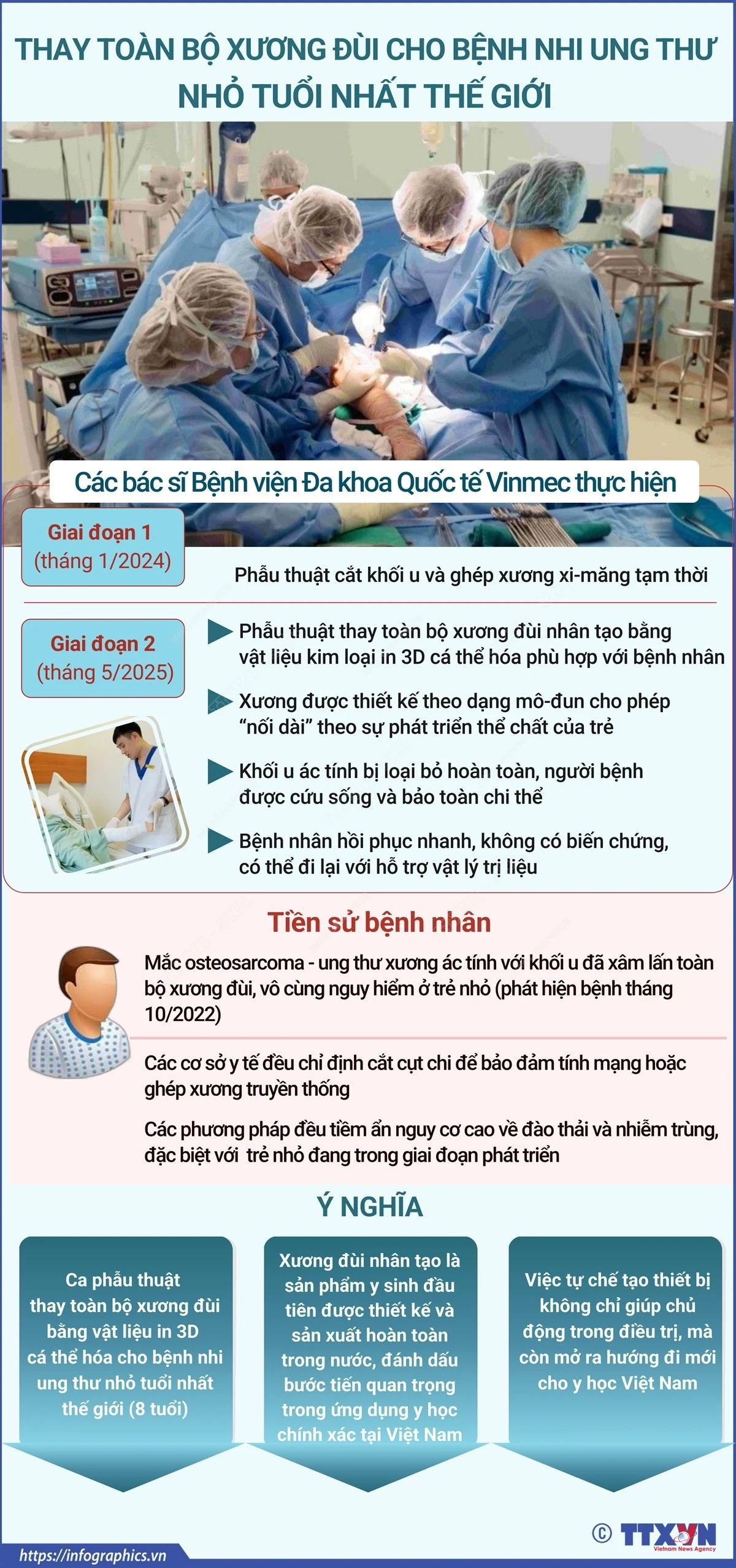 Thay toàn bộ xương đùi cho bệnh nhi ung thư nhỏ tuổi nhất thế giới