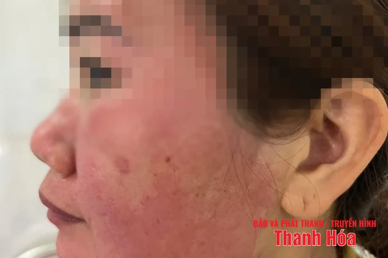 Hàng giả “bủa vây”, ai bảo vệ người tiêu dùng? (Bài 1): Khi người bệnh đặt nhầm niềm tin vào thuốc giả