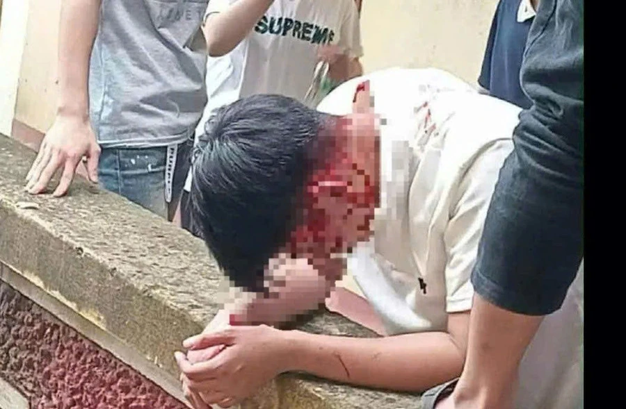 Công an vào cuộc điều tra vụ học sinh đánh nhau trong trường học