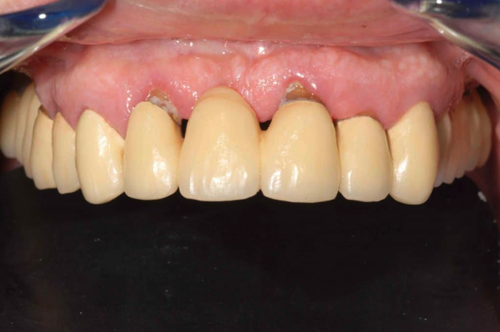 Hành trình tìm lại nụ cười của những người từng mất niềm tin vào nha khoa