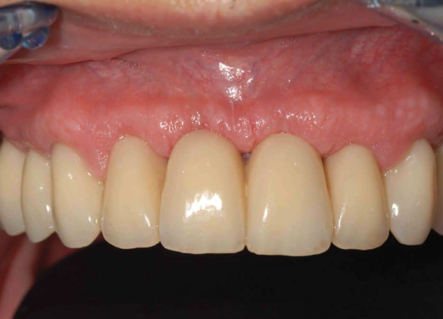 Hành trình tìm lại nụ cười của những người từng mất niềm tin vào nha khoa