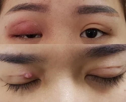 Thẩm mỹ mắt Hoa Tâm: Làm đẹp an toàn cần có những điều kiện, tiêu chí gì?