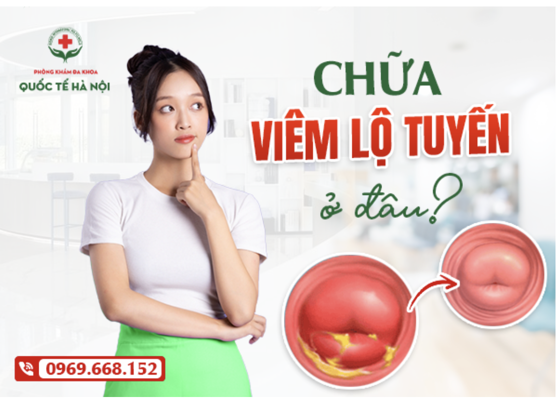 Chữa viêm lộ tuyến ở đâu? Gợi ý địa chỉ nhiều chị em thăm khám