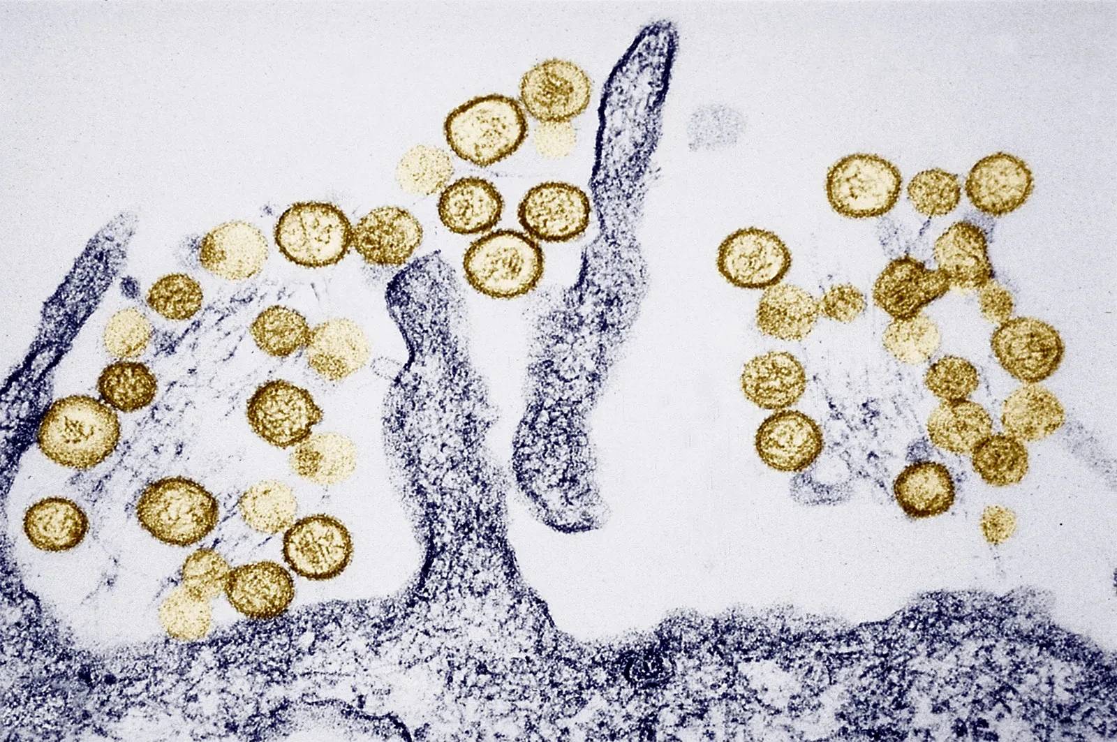 Số ca mắc virus Hanta trên du thuyền Hondius tăng lên 7 trường hợp, 3 người tử vong