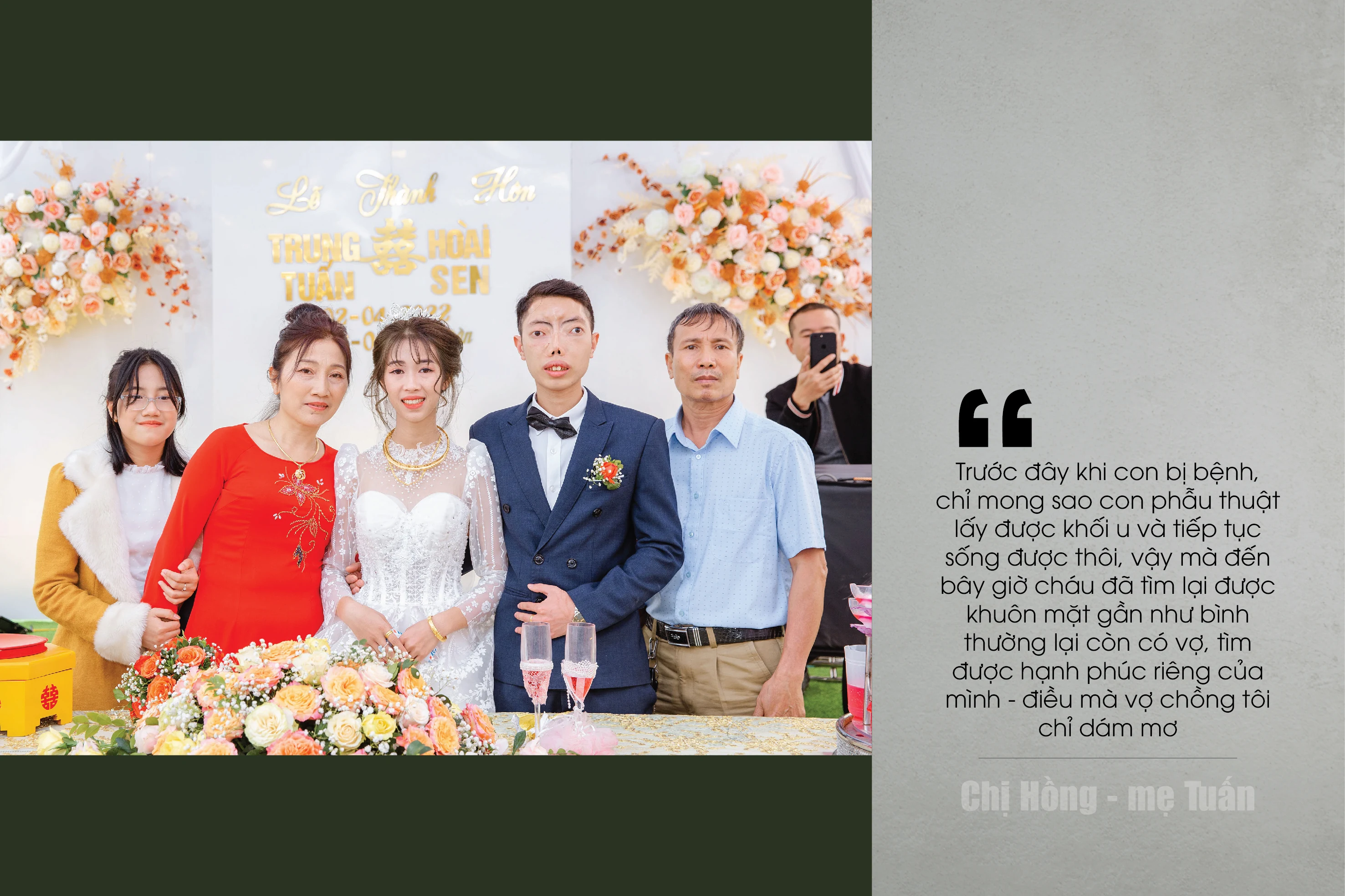 [E-Magazine] - Hành trình tìm lại dung nhan cho cậu bé “không có khuôn mặt”