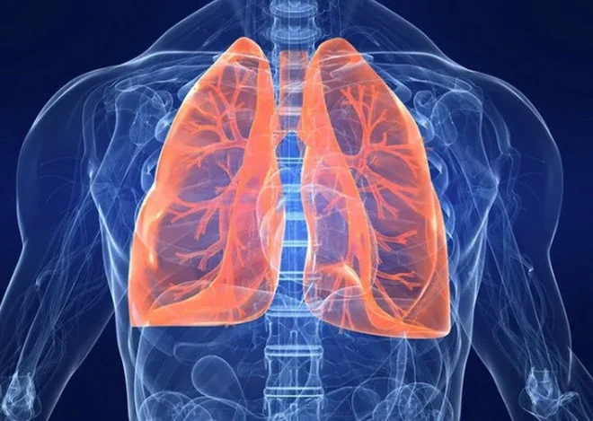 Những biến chứng vô cùng nguy hiểm của bệnh cúm mùa mà bạn cần biết